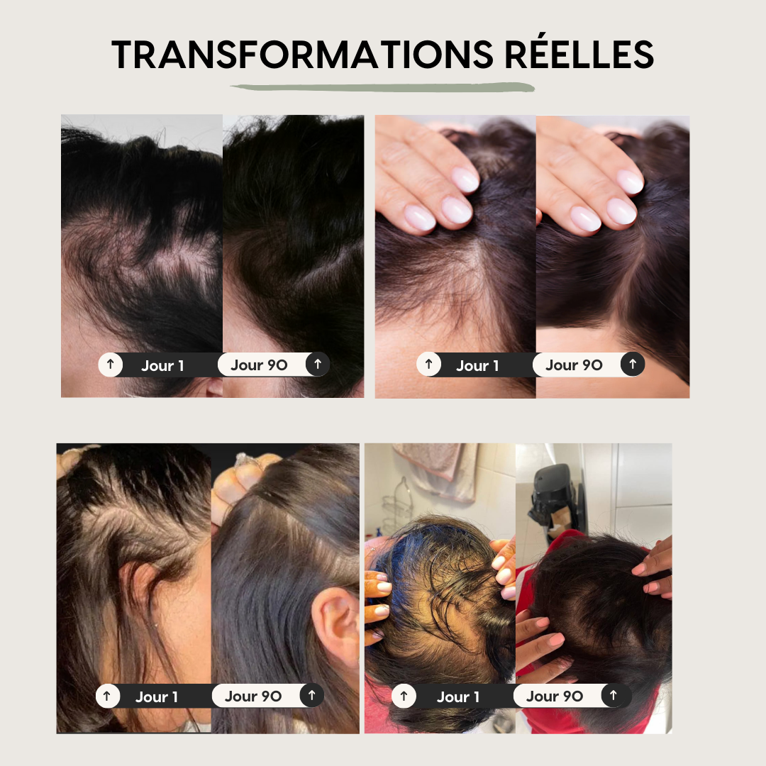 Sérum pousse & anti-chute de cheveux