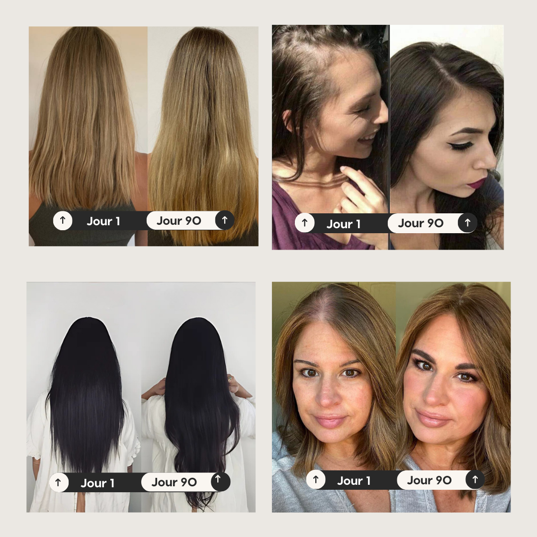 Sérum pousse & anti-chute de cheveux