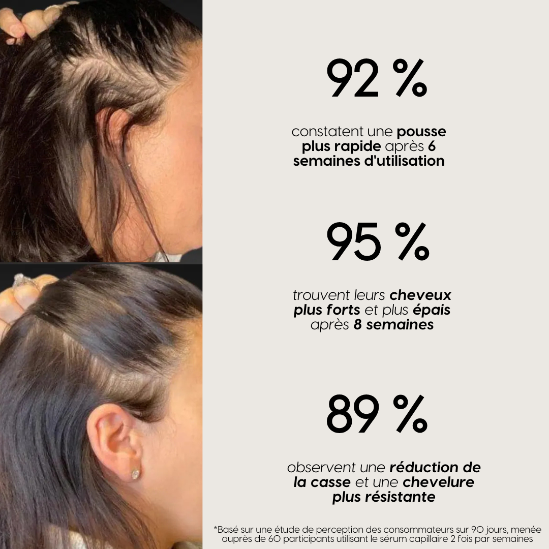 Sérum pousse & anti-chute de cheveux